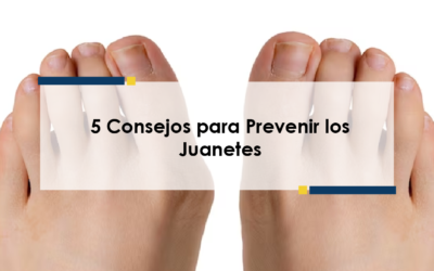 5 Consejos para Prevenir los Juanetes